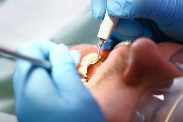 Best Emergency Dental Care for Broken or Chipped Teeth in Perry, UT